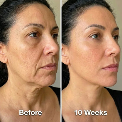 Collagen Face Sculpt Wrap [FREE TODAY]